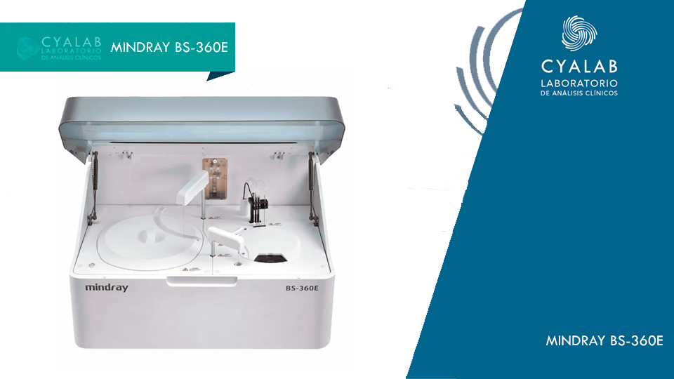 equipamiento-MindrayBS-360E